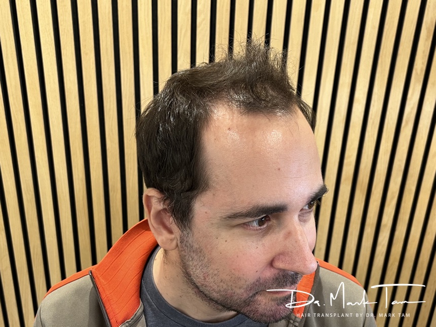 Image of Massimo