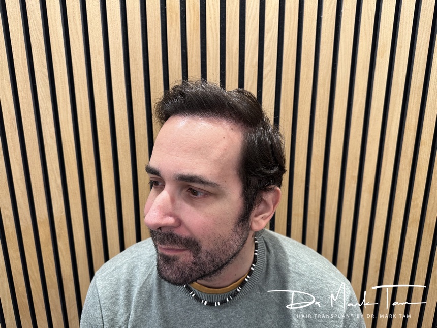 Image of Massimo