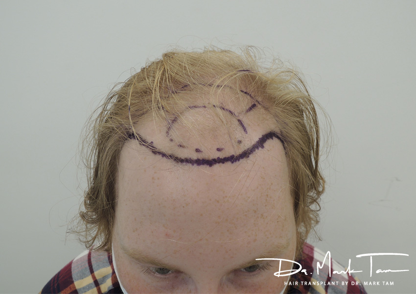 Image of Rhys after the treatment